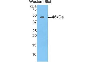 Detection of Recombinant AFP,Pig using Polyclonal Antibody to Alpha-Fetoprotein (AFP)