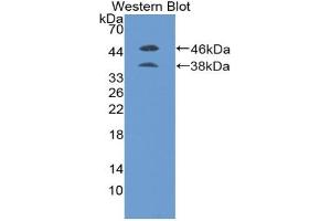 Western blot analysis of the recombinant protein. (PLGF anticorps  (AA 19-158))
