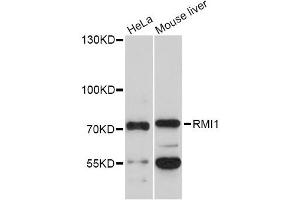 Western blot analysis of extracts of various cell lines, using RMI1 Antibody (ABIN5972890) at 1/1000 dilution. (RMI1 anticorps)