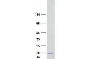 Validation with Western Blot (CARD18 Protein (Myc-DYKDDDDK Tag))