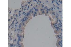 Used in DAB staining on fromalin fixed paraffin- embedded Kidney tissue