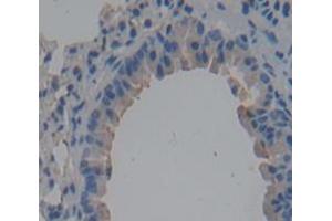 Used in DAB staining on fromalin fixed paraffin- embedded Kidney tissue (CD101 anticorps  (AA 302-531))