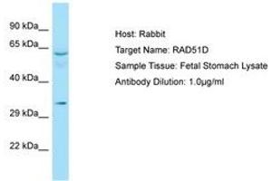 Image no. 1 for anti-RAD51 Homolog D (RAD51D) (AA 259-308) antibody (ABIN6749950) (RAD51D anticorps  (AA 259-308))