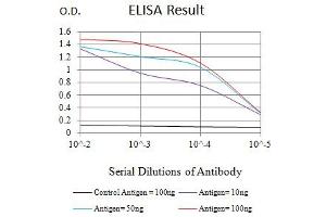 Black line: Control Antigen (100 ng),Purple line: Antigen (10 ng), Blue line: Antigen (50 ng), Red line:Antigen (100 ng) (TUBB3 anticorps)