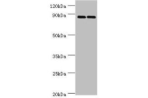 Western blot All lanes: SET and MYND domain-containing protein 4 antibody at 4 μg/mL Lane 1: HepG2 whole cell lysate Lane 2: Hela whole cell lysate Secondary Goat polyclonal to rabbit IgG at 1/10000 dilution Predicted band size: 89 kDa Observed band size: 89 kDa