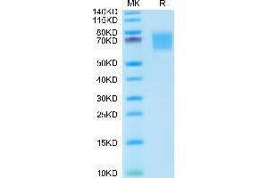 Human FGFR2 alpha (IIIb) on Tris-Bis PAGE under reduced conditions.