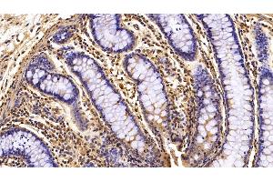Detection of IL8 in Porcine Colon Tissue using Polyclonal Antibody to Interleukin 8 (IL8)
