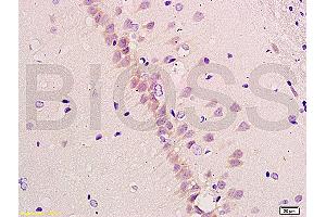 Formalin-fixed and paraffin embedded rat brain tissue labeled with Anti-beta-Amyloid 1-40 (CT) Polyclonal Antibody, Unconjugated (ABIN729328) at 1:200, followed by conjugation to the secondary antibody and DAB staining (Abeta 1-40 anticorps  (C-Term))