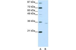 WB Suggested Anti-OTP Antibody Titration:  0. (OTP anticorps  (C-Term))