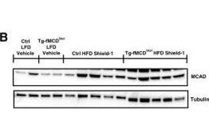 MCD induction suppresses the fatty acid oxidative pathway. (Medium-Chain Specific Acyl-CoA Dehydrogenase, Mitochondrial (MCAD) (Center) anticorps)