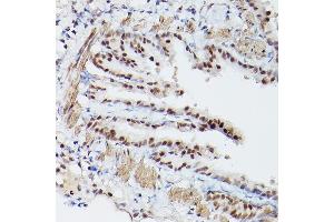 Immunohistochemistry of paraffin-embedded mouse lung using PSME3 Rabbit pAb (ABIN6135015, ABIN6146357, ABIN6146358 and ABIN6216428) at dilution of 1:100 (40x lens). (PSME3 anticorps  (C-Term))