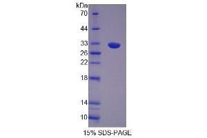 SDS-PAGE analysis of Human OS9 Protein. (OS9 Protéine)