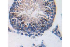 Used in DAB staining on fromalin fixed paraffin- embedded Kidney tissue