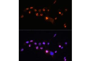 Immunofluorescence analysis of  cells using KLF8 antibody (ABIN7268158) at dilution of 1:100.