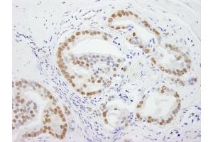 Immunohistochemistry (IHC) image for anti-DEAD (Asp-Glu-Ala-Asp) Box Polypeptide 5 (DDX5) (C-Term) antibody (ABIN7448522)