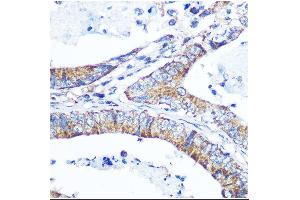 Immunohistochemistry (IHC) image for anti-ATP-Binding Cassette, Sub-Family G (WHITE), Member 1 (ABCG1) (AA 1-220) antibody (ABIN1678514)