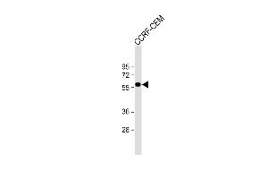 Anti-SLC22A6 Antibody (C-Term) at 1:1000 dilution + CCRF-CEM whole cell lysate Lysates/proteins at 20 μg per lane. (SLC22A6 anticorps  (C-Term))