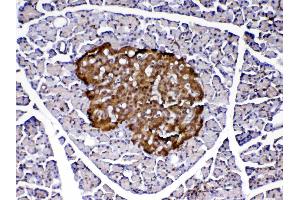 IHC analysis of PARK7 / DJ1 using anti-PARK7 / DJ1 antibody .