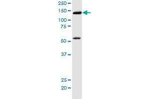 KIF5B monoclonal antibody (M01), clone 2A11.