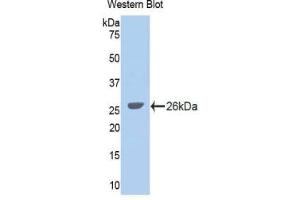 Detection of Recombinant GLDC, Human using Polyclonal Antibody to Glycine Dehydrogenase (GLDC) (GLDC anticorps  (AA 627-833))