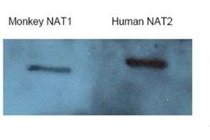 Western Blotting (WB) image for anti-N-Acetyltransferase 2 (Arylamine N-Acetyltransferase) (NAT2) (Middle Region) antibody (ABIN310568) (NAT2 anticorps  (Middle Region))