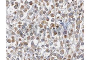 ABIN6268680 at 1/100 staining human breast tissues sections by IHC-P.