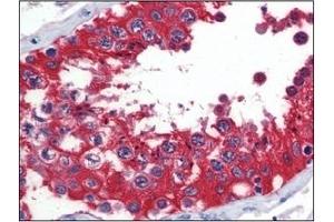 Immunohistochemistry (IHC) image for anti-Glucose-6-Phosphate Dehydrogenase (G6PD) (AA 35-506) antibody (ABIN400862)