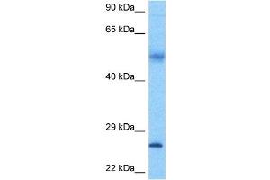 Host:  Rabbit  Target Name:  FAM3A  Sample Tissue:  Human Ovary Tumor lysates  Antibody Dilution:  1ug/ml (FAM3A anticorps  (C-Term))