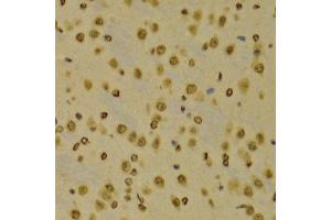 Immunohistochemistry of paraffin-embedded Mouse brain using H3K9me3 antibody at dilution of 1:100 (x400 lens). (Histone 3 anticorps  (H3K9me3))