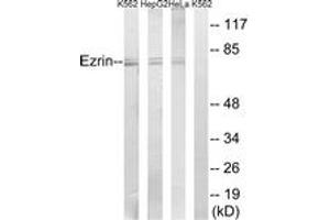 Western blot analysis of extracts from HeLa/HepG2/K562 cells, using Ezrin (Ab-146) Antibody. (Ezrin anticorps  (AA 111-160))
