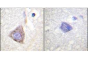 Immunohistochemistry (IHC) image for anti-Breakpoint Cluster Region (BCR) (AA 331-380) antibody (ABIN2888761) (BCR anticorps  (AA 331-380))