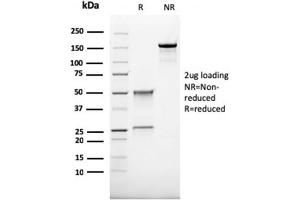 SDS-PAGE Analysis Purified CD68 Recombinant Mouse Monoclonal Antibody (rLAMP4/824).