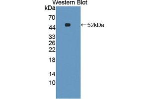Western blot analysis of the recombinant protein. (CCBL1 anticorps  (AA 1-422))