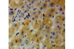 IHC-P analysis of Liver tissue, with DAB staining. (PHLDA2 anticorps  (AA 1-152))