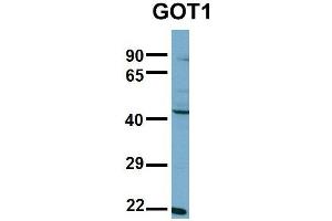 Host:  Rabbit  Target Name:  GOT1  Sample Type:  NCI-H226  Antibody Dilution:  1. (GOT1 anticorps  (N-Term))