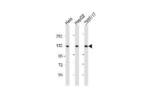 Western Blot at 1:2000 dilution Lane 1: Hela whole cell lysate Lane 2: HepG2 whole cell lysate Lane 3: 293T/17 whole cell lysate Lysates/proteins at 20 ug per lane. (LRIG3 anticorps  (AA 23-54))