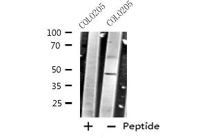 Western blot analysis of extracts from COLO205 cells using CRHR2 antibody. (CRHR2 anticorps  (Internal Region))