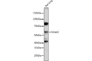 Western blot analysis of extracts of Rat lung, using Smad2 antibody (ABIN7270344) at 1:1000 dilution. (SMAD2 anticorps)