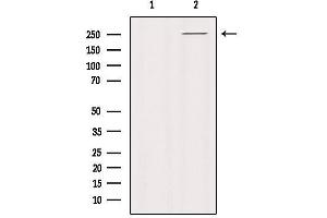Western blot analysis of extracts from HUVEC, using PTPRZ1 Antibody.