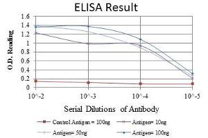 Red: Control Antigen (100 ng), Purple: Antigen (10 ng), Green: Antigen (50 ng), Blue: Antigen (100 ng), (RUNX1 anticorps)