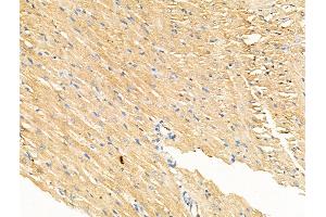 Phospho-IL4R/CD124 (Tyr497) Antibody at 1/100 staining Rat heart tissue by IHC-P. (IL4 Receptor anticorps  (pTyr497))