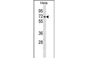 Western blot analysis in Hela cell line lysates (35ug/lane). (CPSF6 anticorps  (N-Term))