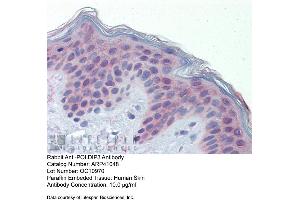 Immunohistochemistry (IHC) image for anti-Polymerase (DNA-Directed), delta Interacting Protein 3 (POLDIP3) (C-Term) antibody (ABIN2776594) (POLDIP3 anticorps  (C-Term))