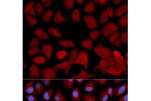 Immunofluorescence analysis of U2OS cells using PSMC4 Polyclonal Antibody