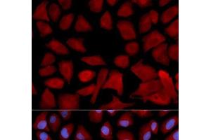 Immunofluorescence analysis of U2OS cells using PSMC4 Polyclonal Antibody