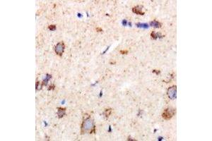 Immunohistochemical analysis of CHMP1B staining in rat brain formalin fixed paraffin embedded tissue section. (CHMP1B anticorps)