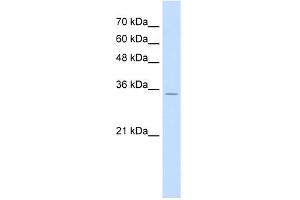 WB Suggested Anti-RNF39 Antibody Titration:  0. (RNF39 anticorps  (N-Term))