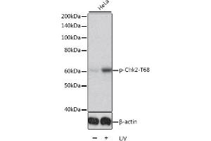 Western blot analysis of extracts of HeLa cells, using Phospho-Chk2-T68 antibody (ABIN6135202, ABIN6136046, ABIN6136047 and ABIN6225610). (CHEK2 anticorps  (pThr68))