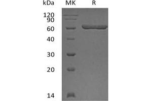 Western Blotting (WB) image for Lectin, Galactoside-Binding, Soluble, 9 (LGALS9) protein (GST tag) (ABIN7319811)