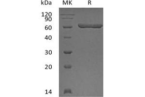 Western Blotting (WB) image for Lectin, Galactoside-Binding, Soluble, 9 (LGALS9) protein (GST tag) (ABIN7319811) (Galectin 9 Protein (GST tag))